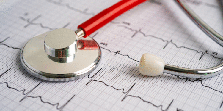 Żyj zdrowo, badaj puls – chroń się przed udarem!