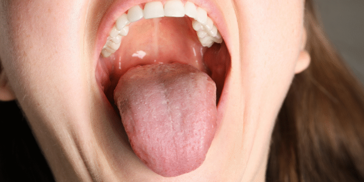 Listopad pod znakiem „Niebieskich Ust” – kampania na rzecz profilaktyki raka jamy ustnej